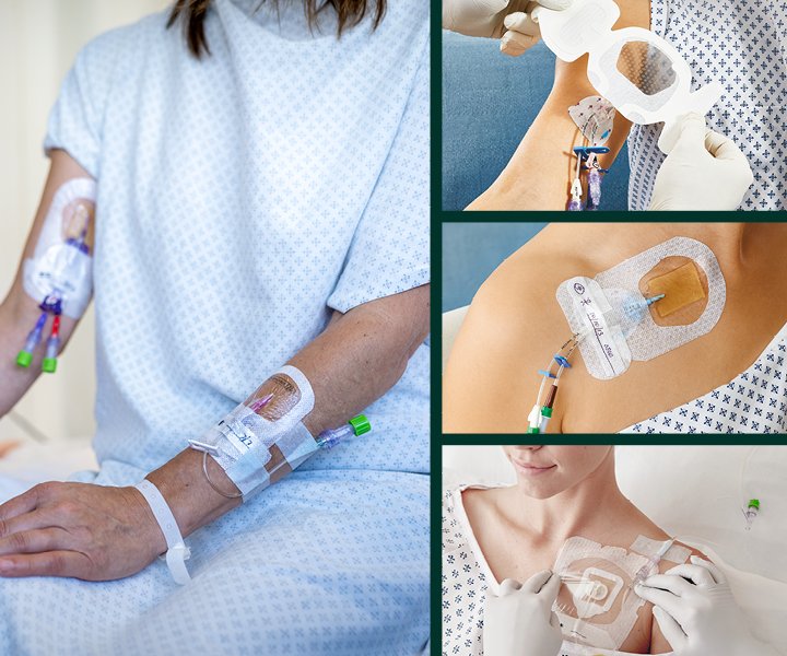 Collage VAS Catheters PICC, PIV, CVC, Port different formats CER 1 360x300