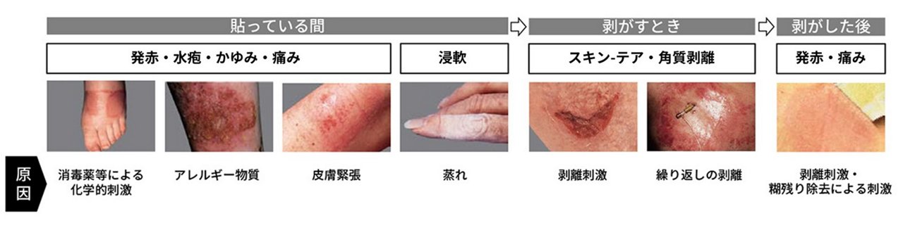 causes_skin_trouble-r