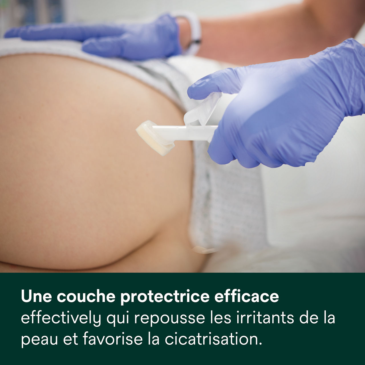 (3) Cavilon Advanced : Une barrière protectrice qui repousse efficacement les irritants cutanés