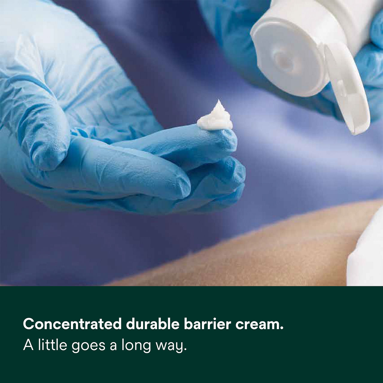 (1) Cavilon Durable Barrier Cream: Concentrated durable barrier cream. A little goes a long way