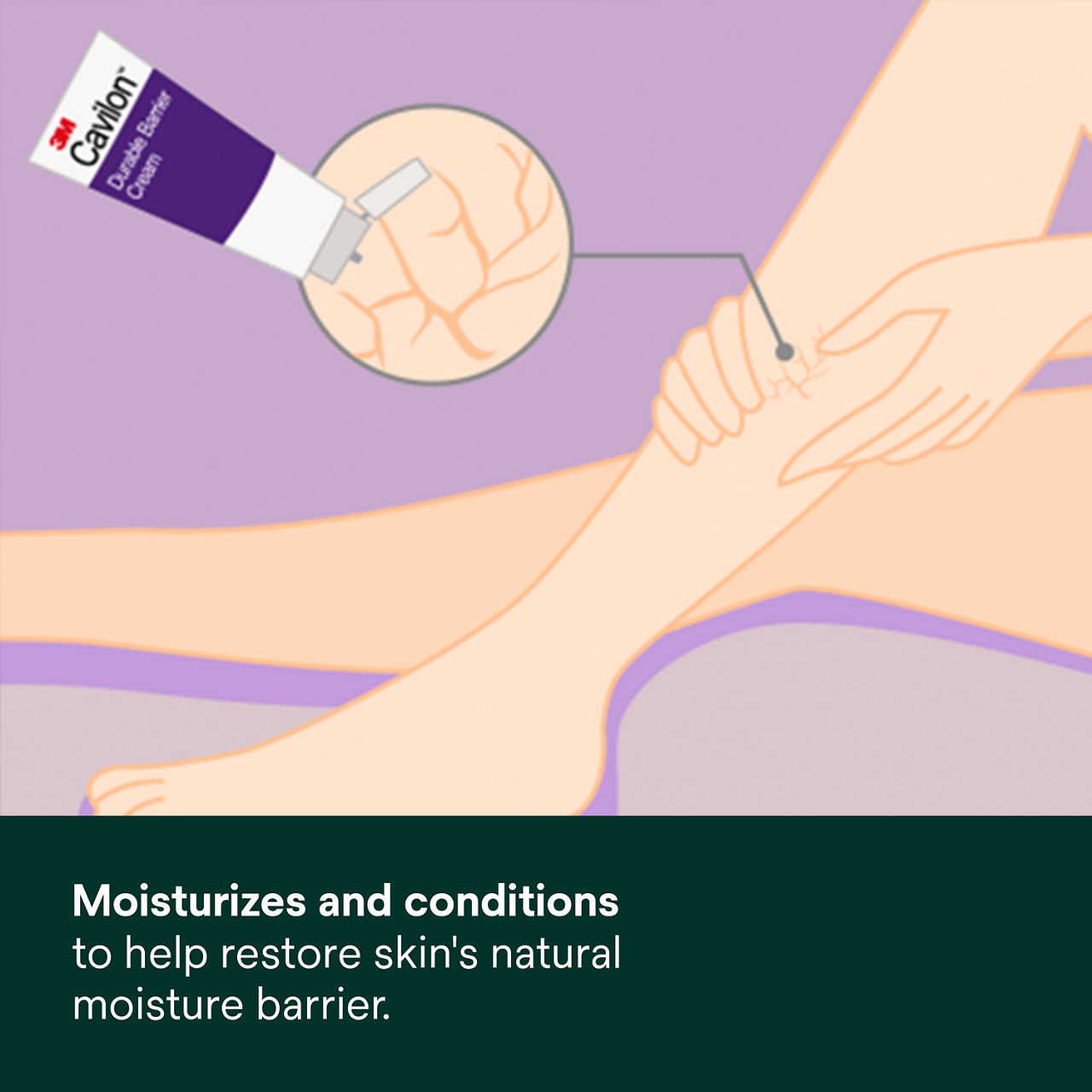 (3) Cavilon Durable Barrier Cream: Moisturizes and conditions