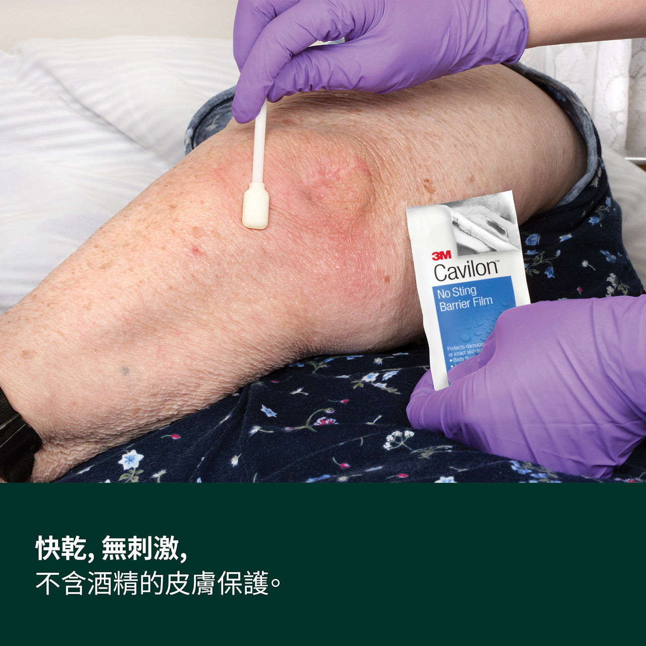 (1) Cavilon 無痛保膚膜：快速乾燥、無痛、無酒精的保護