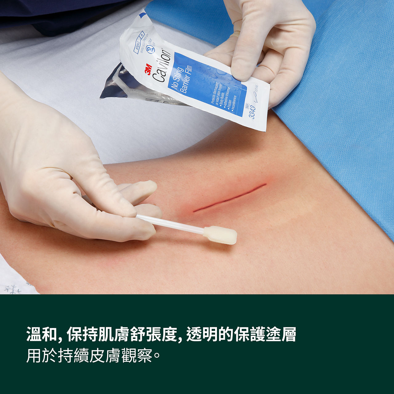 (3) Cavilon 無痛保膚膜：溫和、靈活多變、透明的保護塗層