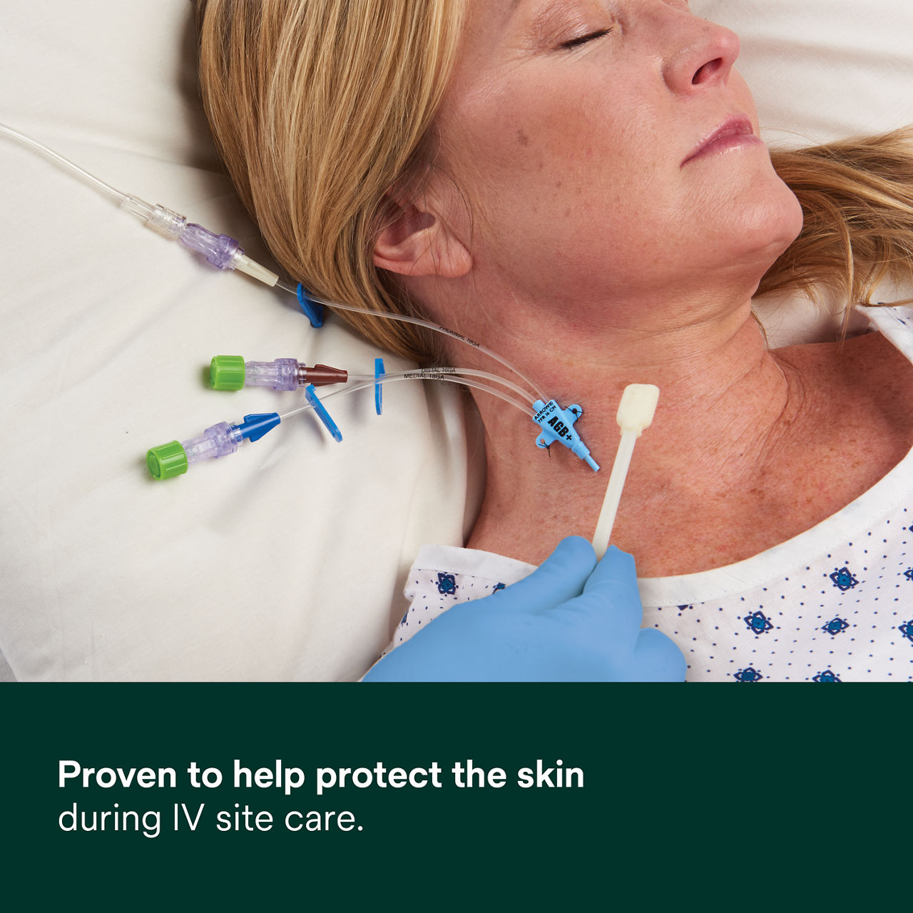 (4) Cavilon No Sting Barrier Film: Proven to help protect the skin during IV site care