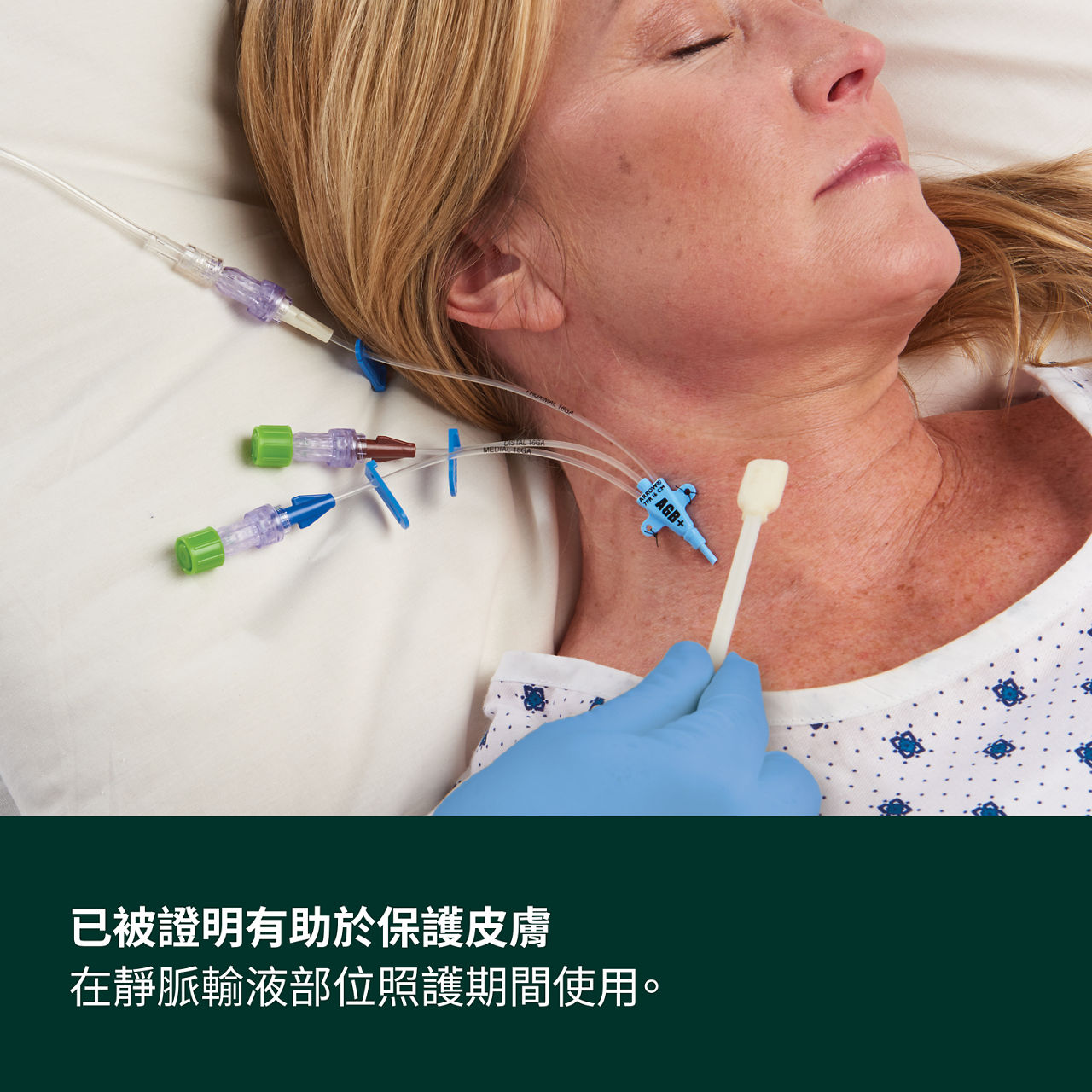 (4) Cavilon無痛保膚膜：經證實可在進行 IV 部位护理時幫助保護皮肤