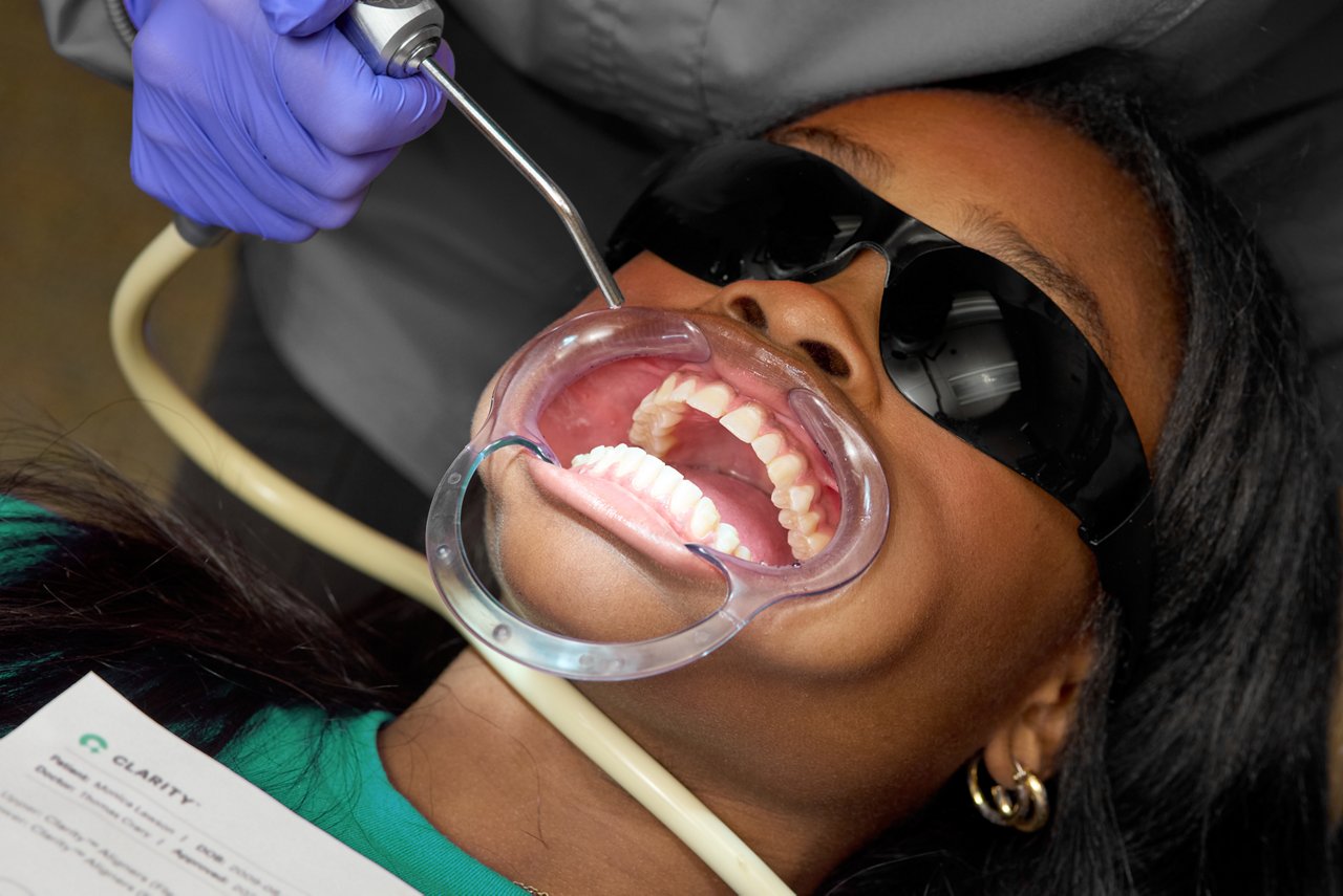 Isolate teeth using a dry field system.