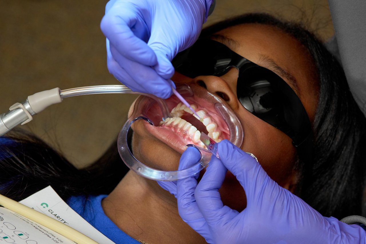 Prepare the tooth surface.