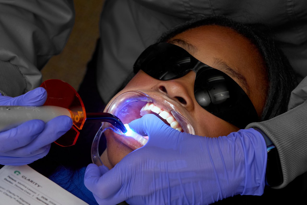 Place tray in patient's mouth and light cure each attachment.