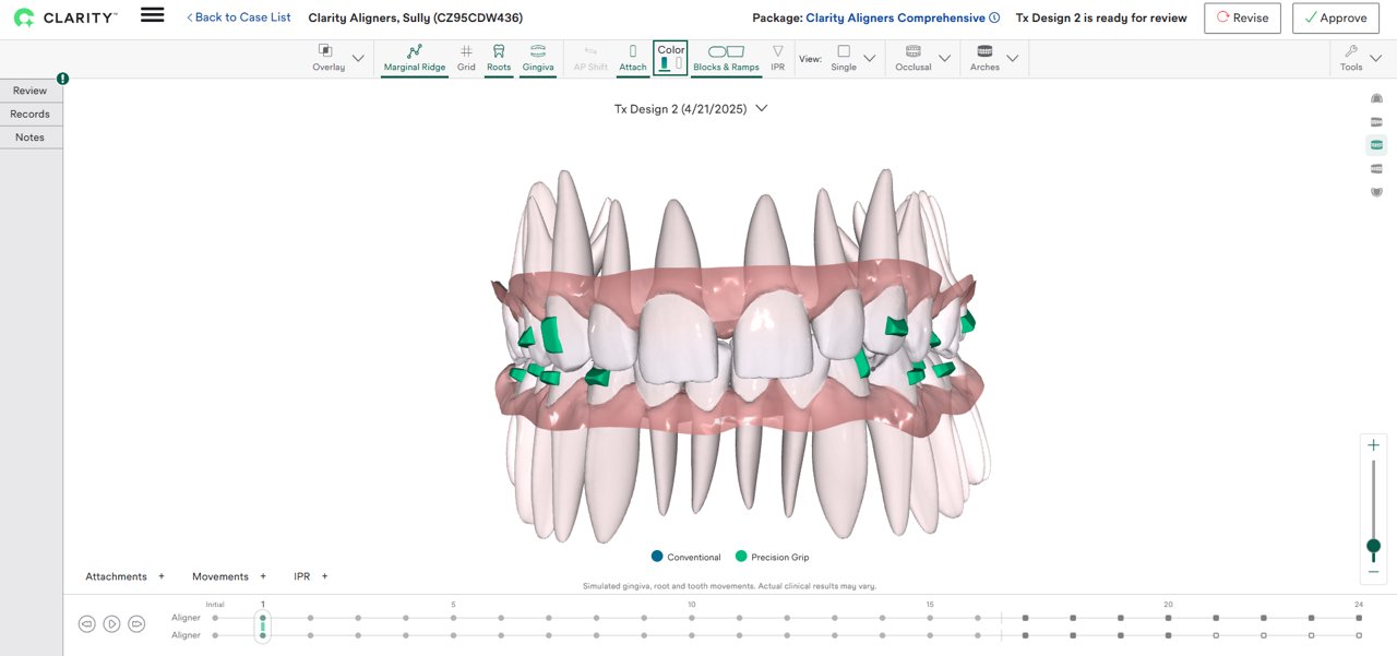 Image of Tx Designer Page with Single View Roots and Precision Grip.
