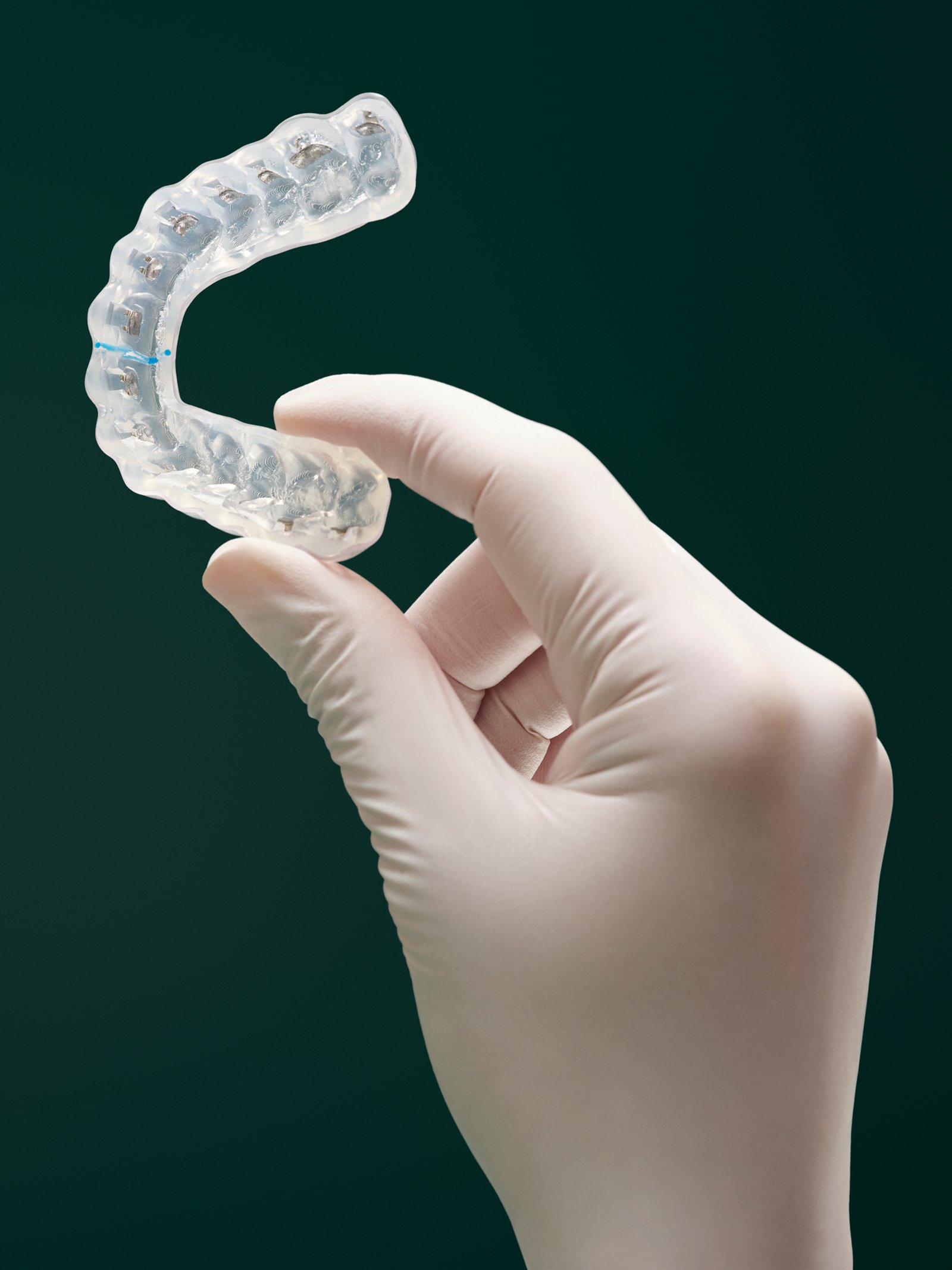 A white gloved hand on a dark green background holds up an orthodontic 3M Digital Bonding Tray with brackets installed.