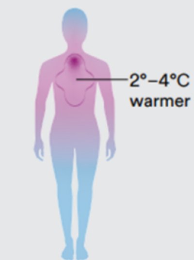 Bild, das die Auswirkungen von Anästhesie auf die Körpertemperatur zeigt, auf weißem Hintergrund