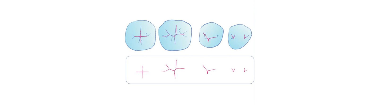 Drawing of essential lines found in mandibular premolars and molars