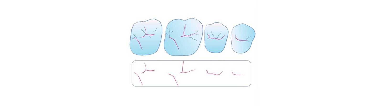 Drawing of essential lines found in maxillary premolars and molars