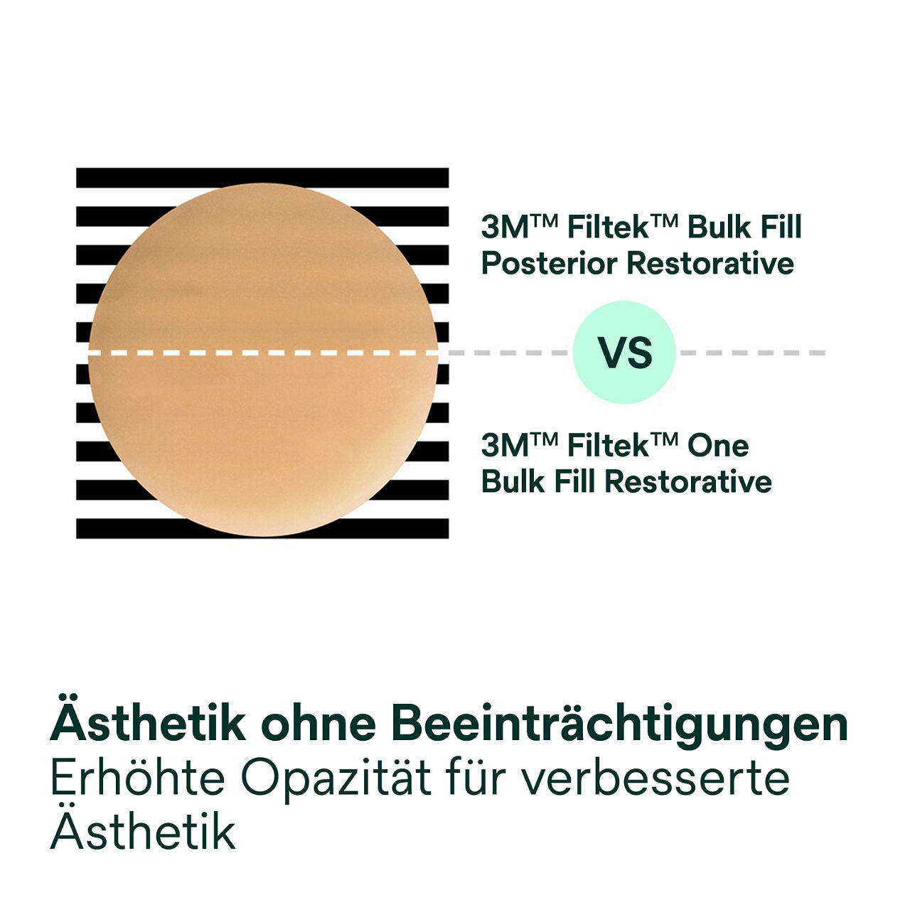 3- Filtek One Bulk Fill: Ästhetik ohne Beeinträchtigungen