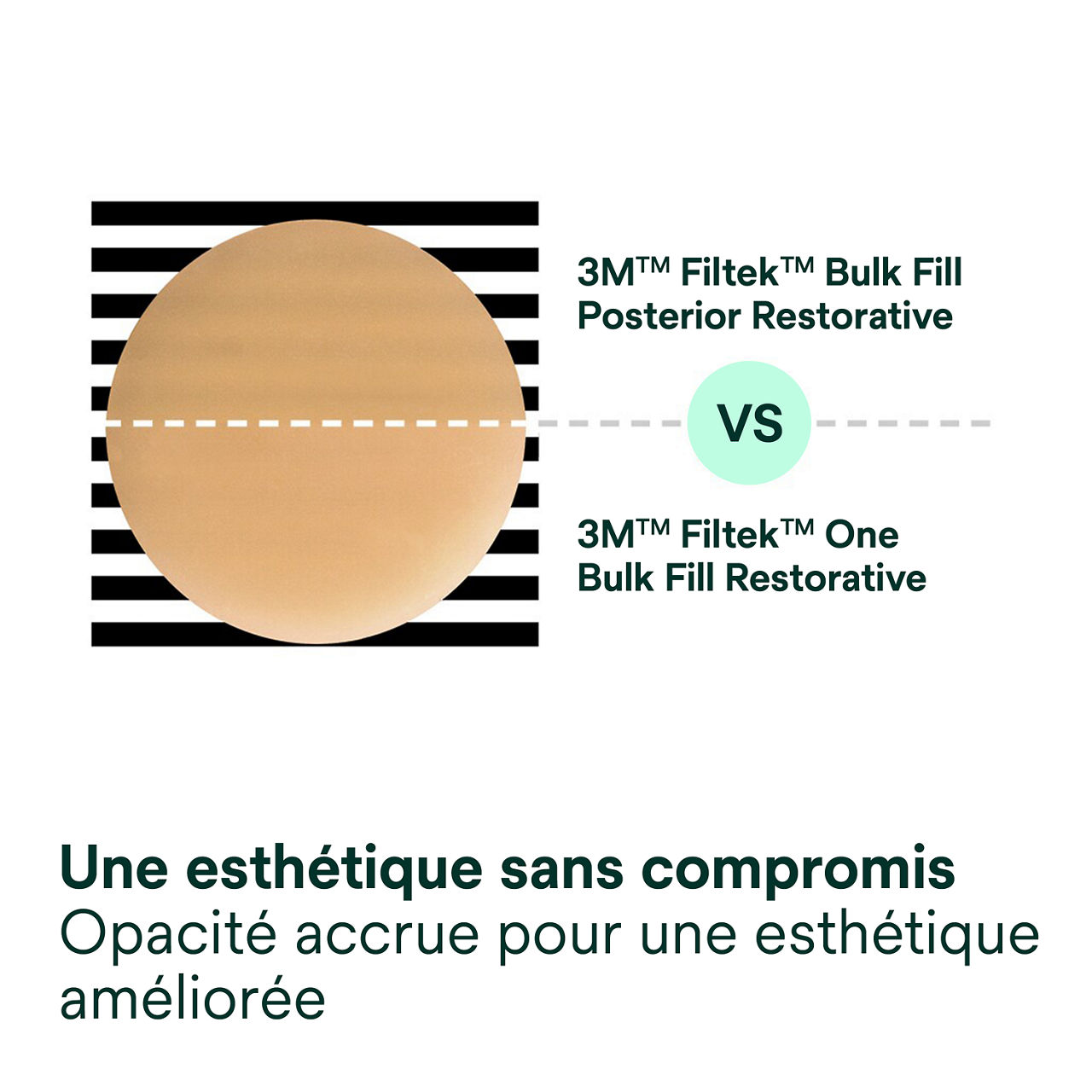 3- Filtek™ One Bulk Fill: Une esthétique sans compromis –