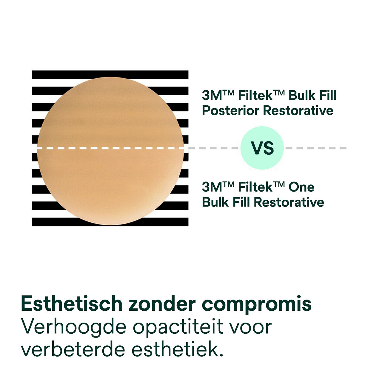 3- Filtek One Bulk Fill:  Esthetisch zonder compromis
