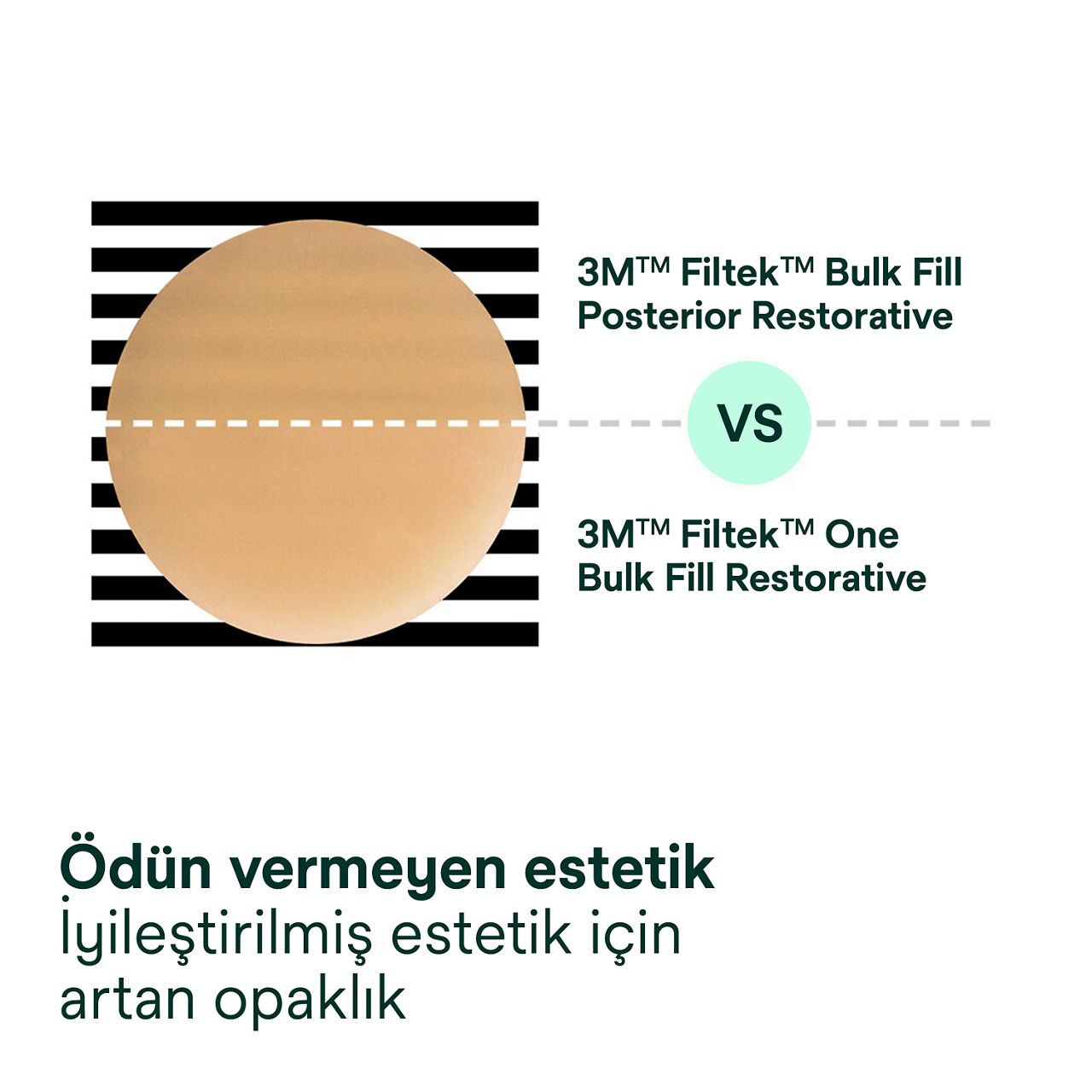 3- Filtek One Bulk Fill: Ödün vermeyen estetik