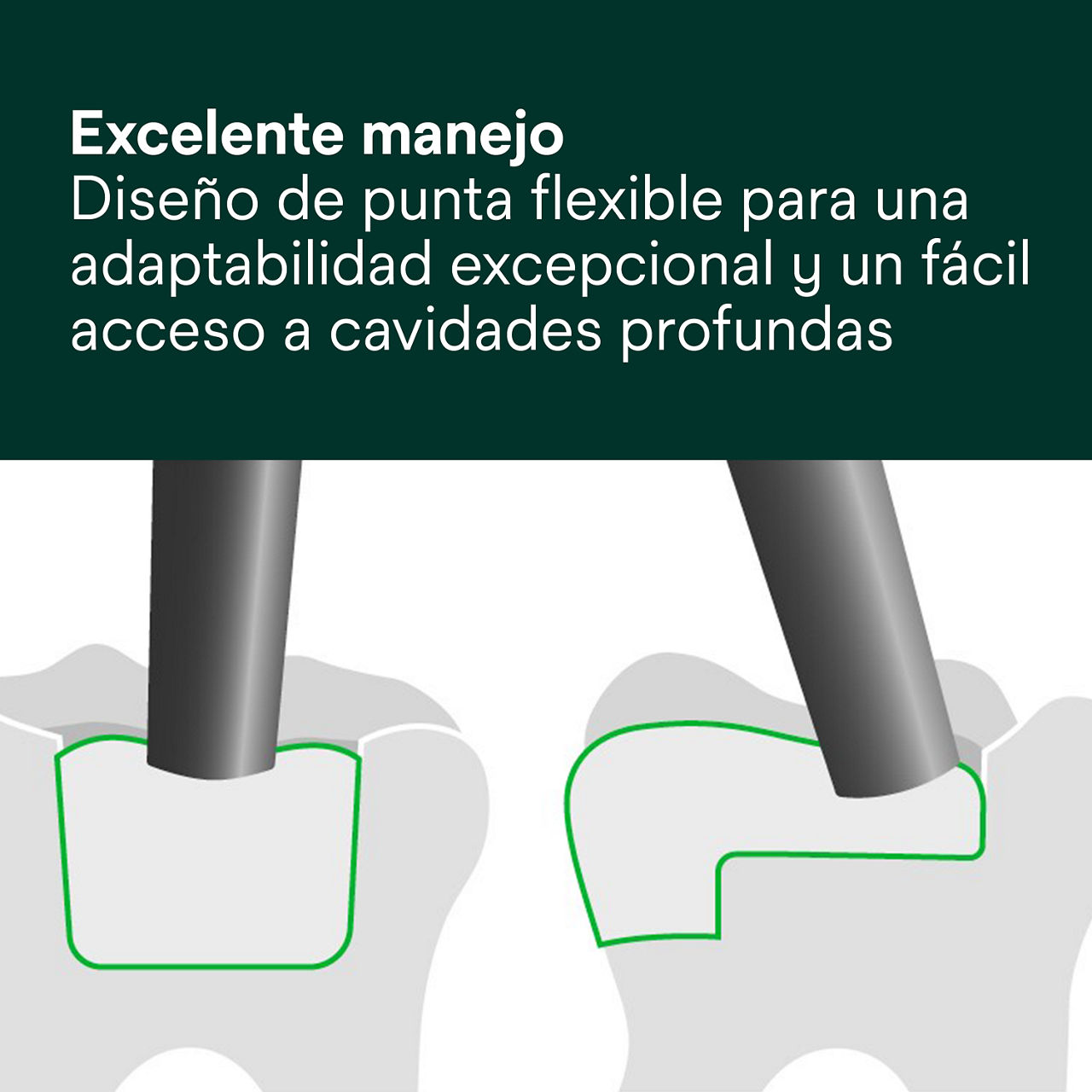 4- Filtek One Bulk Fill: Excelente manejo