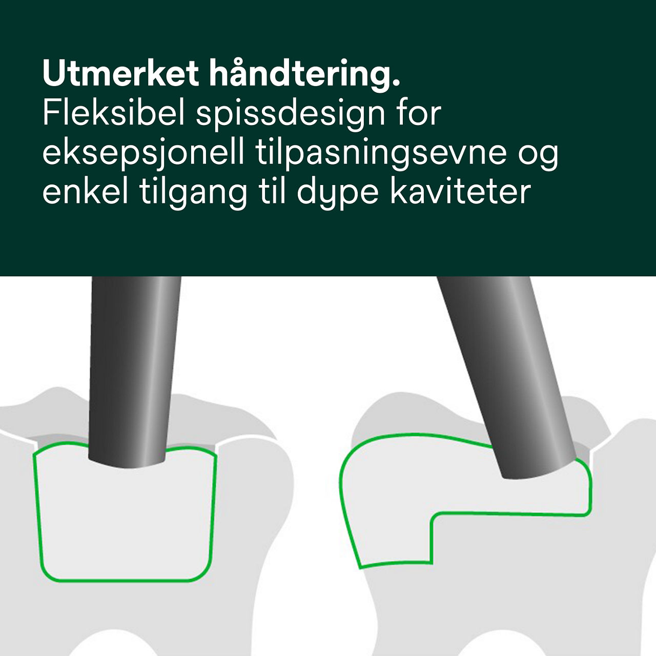 4- Filtek™ One Bulk Fill: Utmerket håndtering