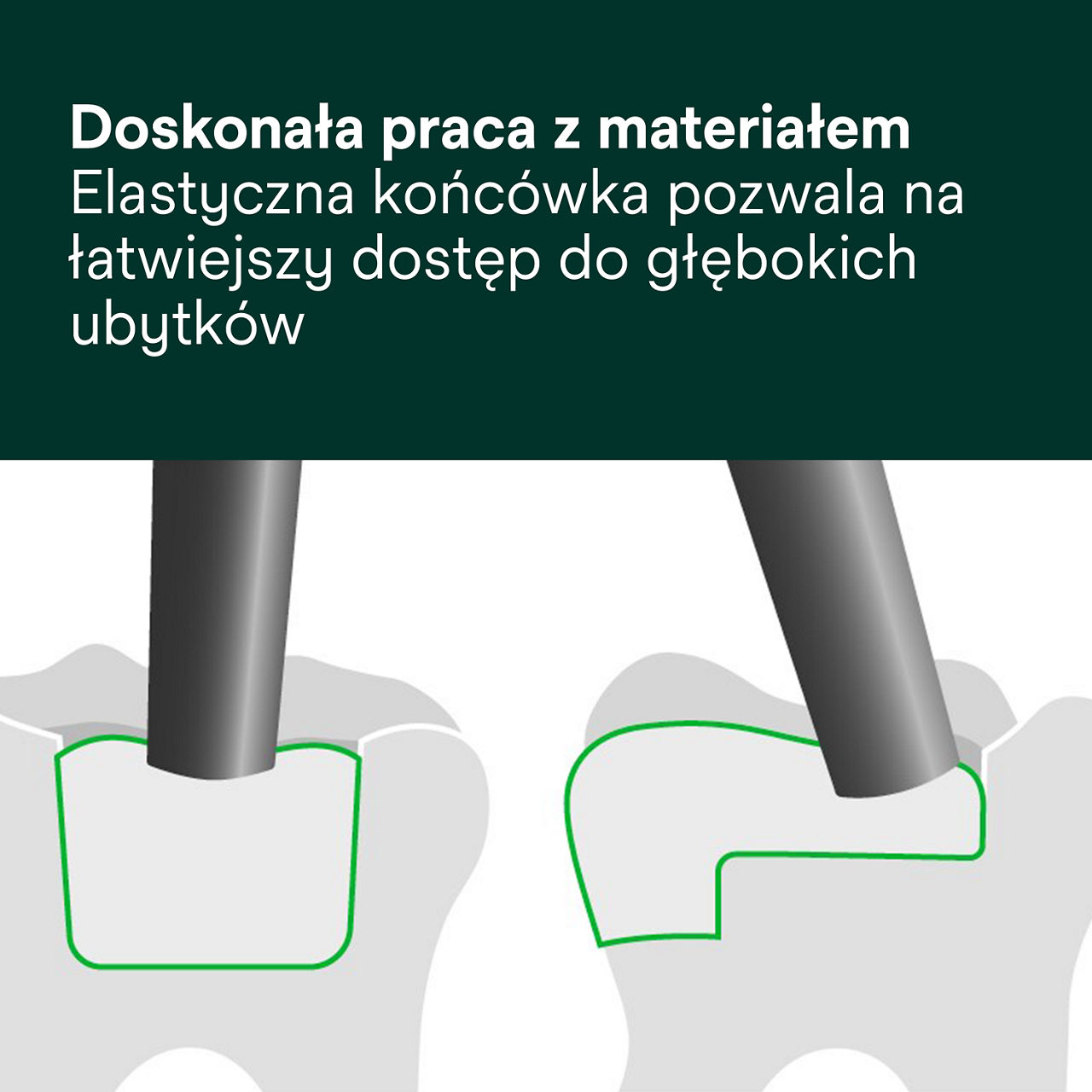 4- Filtek One Bulk Fill: Doskonała praca z materiałem