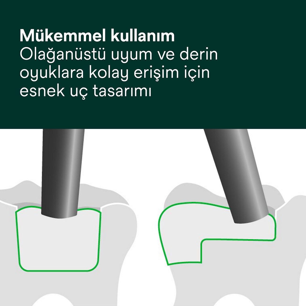 4- Filtek One Bulk Fill: Mükemmel kullanım