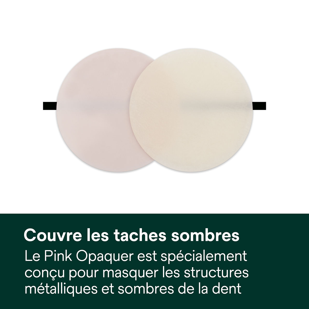 3- Filtek™ Universal: Couvre les taches sombres.