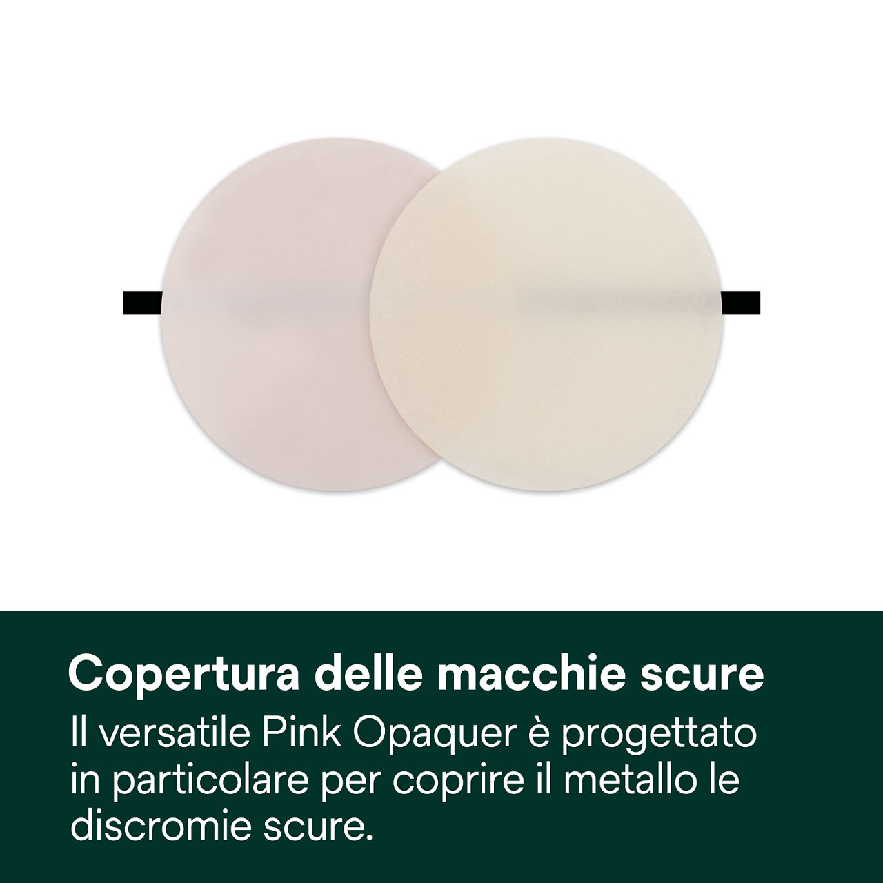 3- Filtek Universal: Copertura delle macchie scure