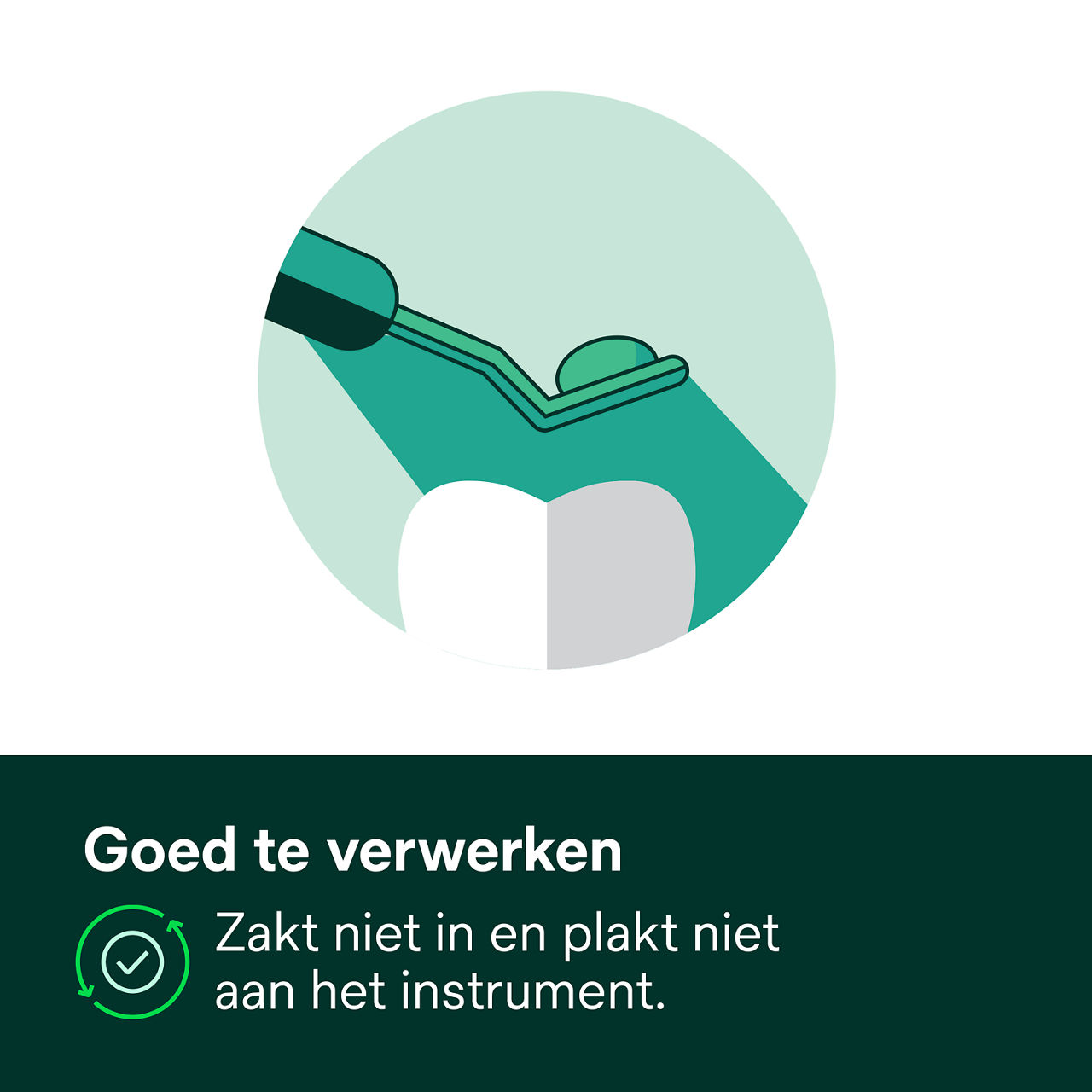 2- Filtek Z250 Universal: Goed te verwerken