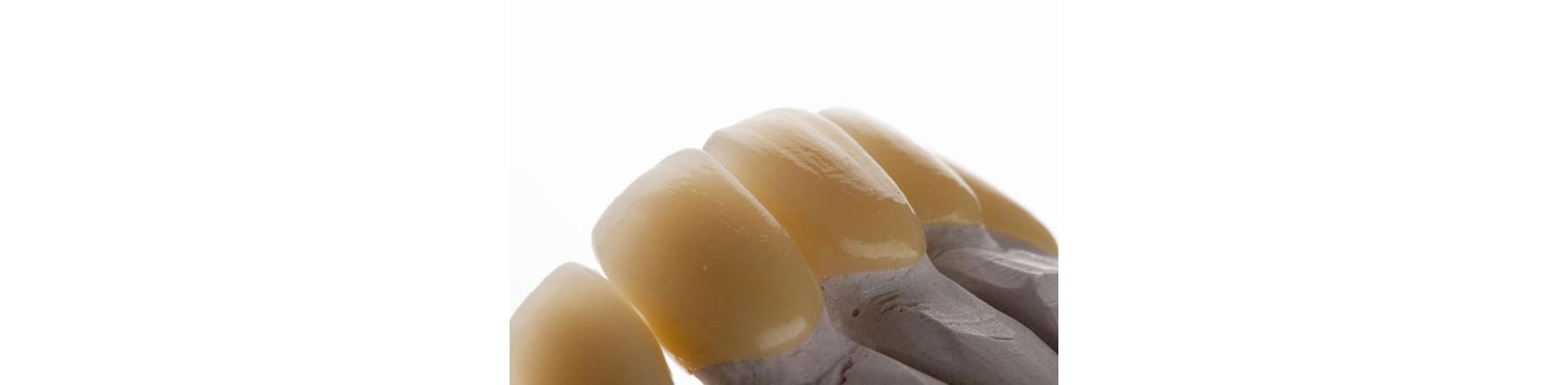 Final restorations with esthetic zirconia crowns