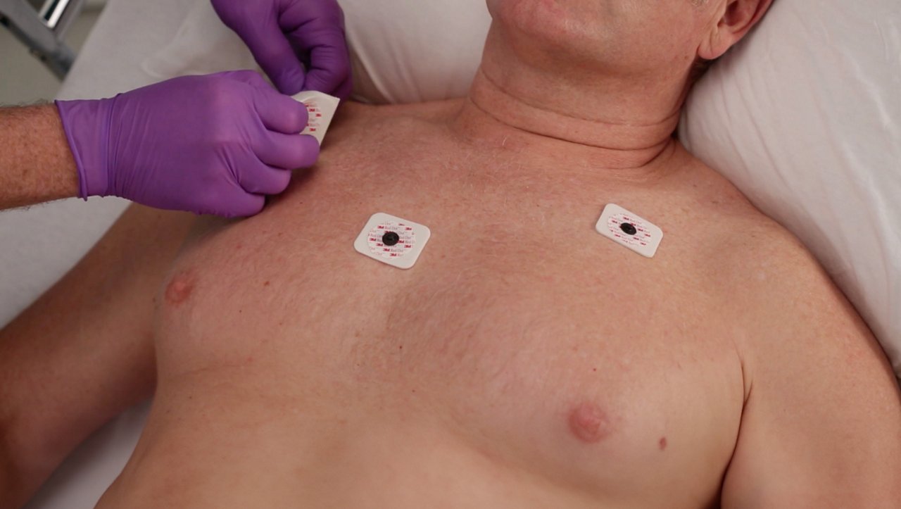 An adult having electrodes applied to his chest