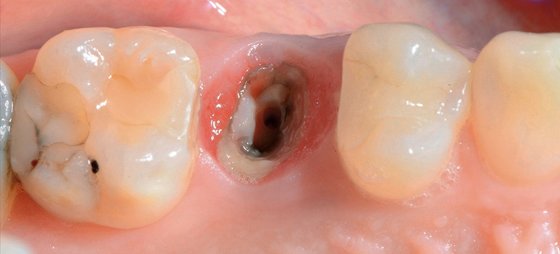 Initial situation, occlusal view