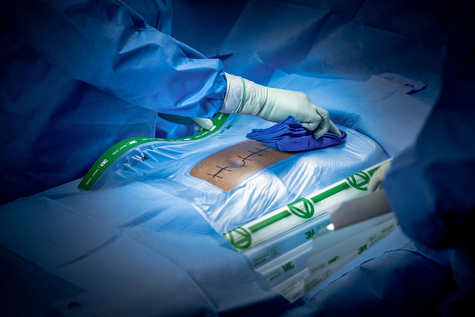 An OR nurse uses a towel to securely apply the drape to a patient's abdomen.