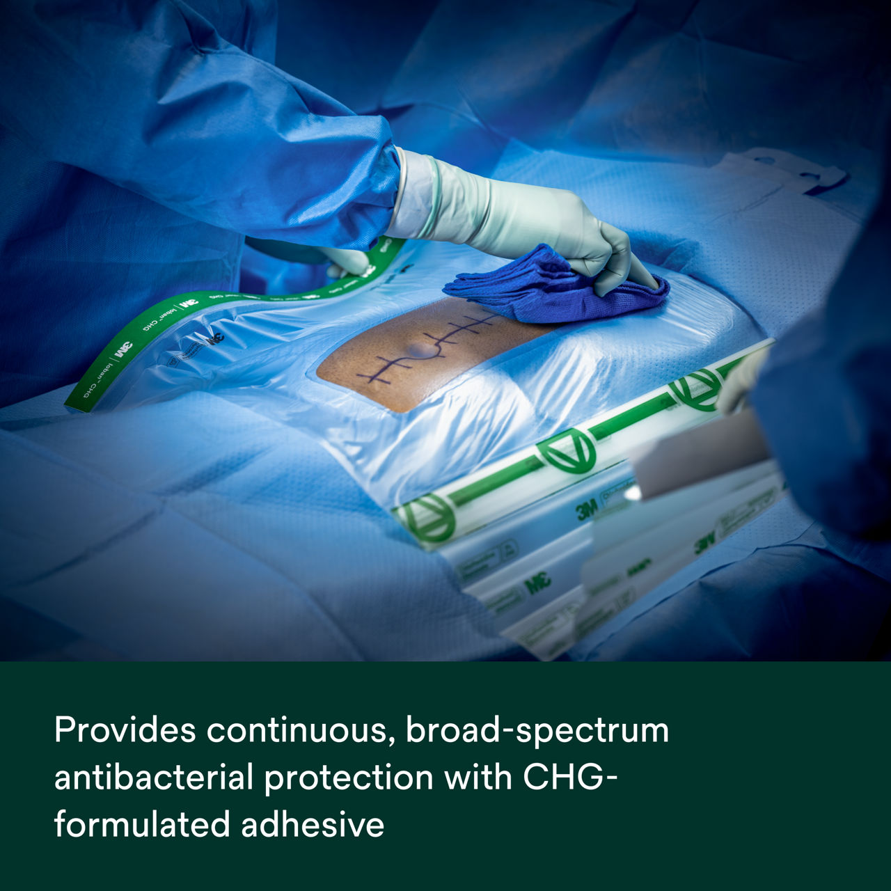 Ioban CHG Chlorhexidine Gluconate Incise Drape (contains 2% w/w CHG) PDP Secondary Image 1