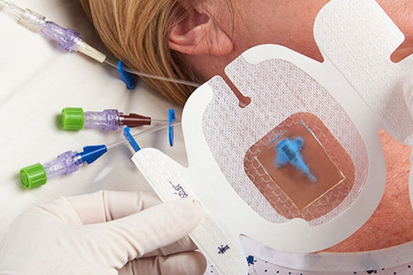 Kuva iv-hoidon antimikrobisesta verkkosivusta
