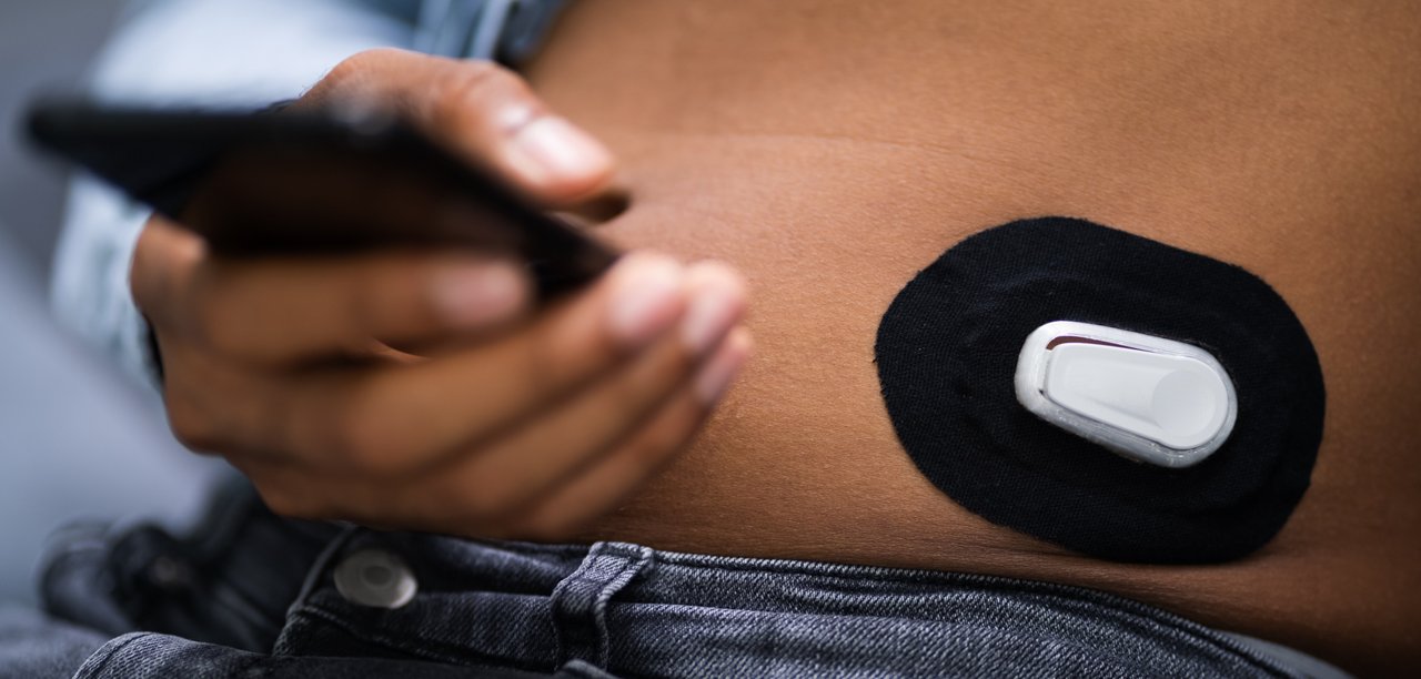 Man Testing Glucose Level With Continuous Glucose Monitor On Mobile Phone