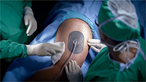 3M V.A.C. Peel and Place Dressing with 3M SensaT.R.A.C. Pad placed on patient in operating room with surgeon smoothing dressing.
