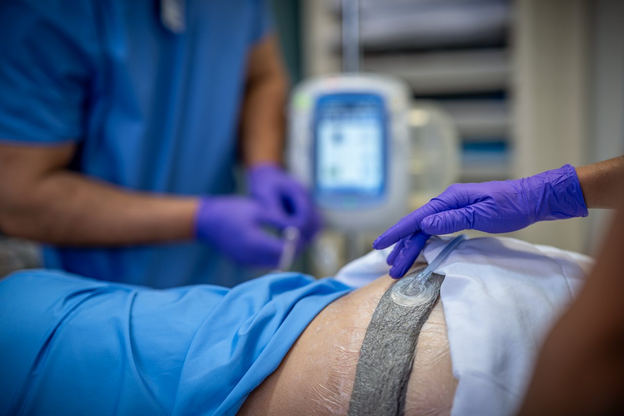 3M™ V.A.C.® Ulta Therapy Unit with 3M™ V.A.C.® Granufoam Silver™ Dressing in ICU, Product Application, People Image, rgb, tif