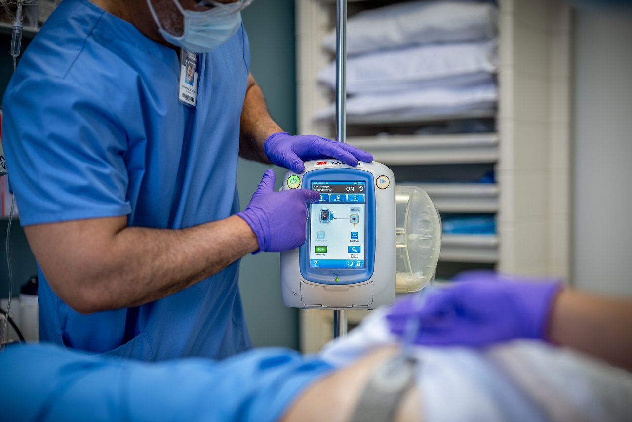 3M™ V.A.C.® Ulta Therapy Unit with 3M™ V.A.C.® Granufoam Silver™ Dressing in ICU, Product Application, People Image, rgb, tif