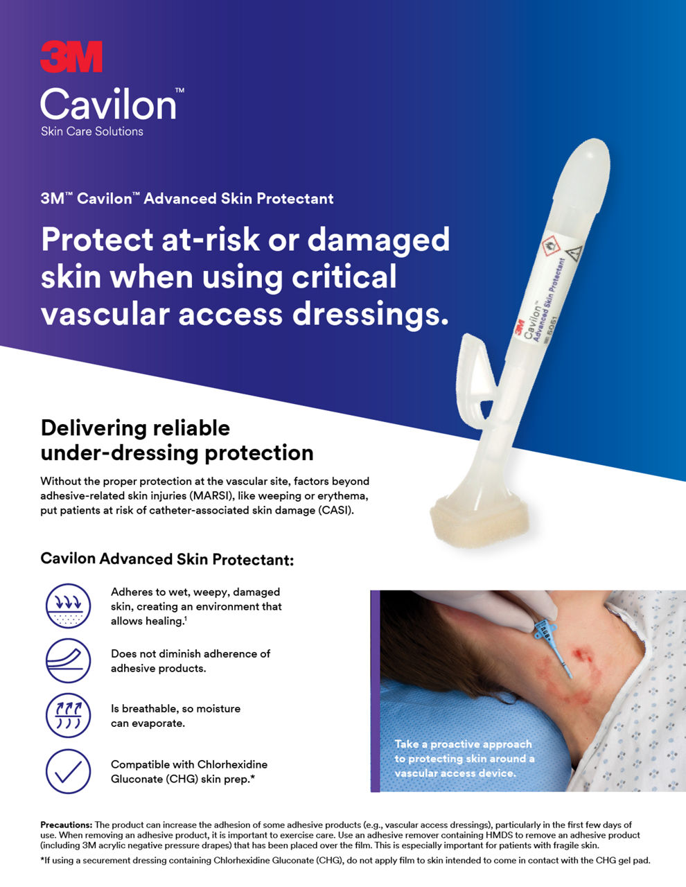 Voorbeeld van de voorpagina van de flyer voor vaattoegangsbescherming met Cavilon Advanced Skin Protectant
