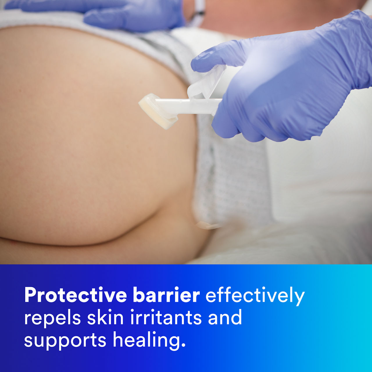 3 - Cavilon Advanced: Protective barrier effectively  (en-ca)