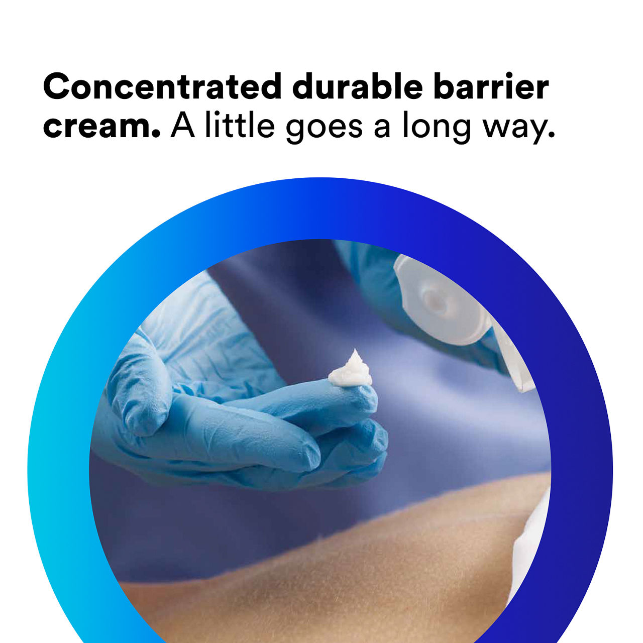 (1) Cavilon Durable Barrier Cream: Concentrated durable barrier cream. A little goes a long way