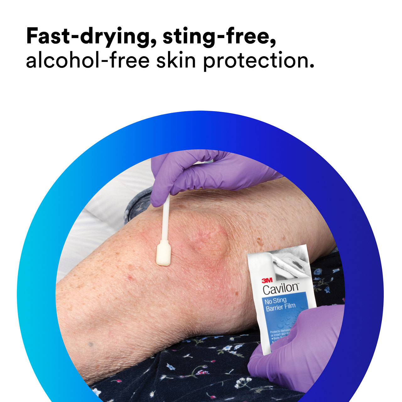 (1) Cavilon No Sting Barrier Film: Fast-drying, sting-free, alcohol-free protection