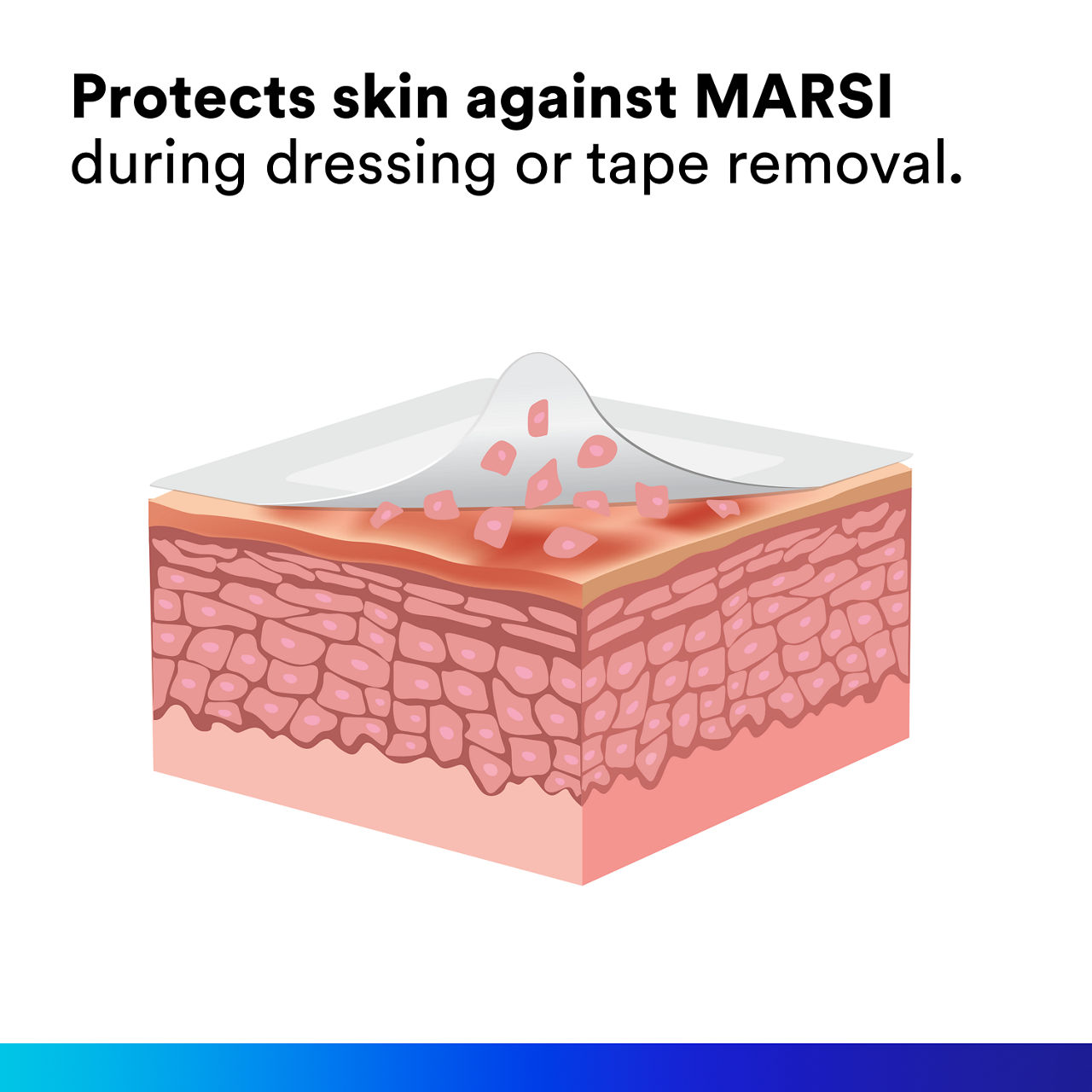 (2) Cavilon No Sting Barrier Film: Protects Skin Against MARSI during dressing or tape removal