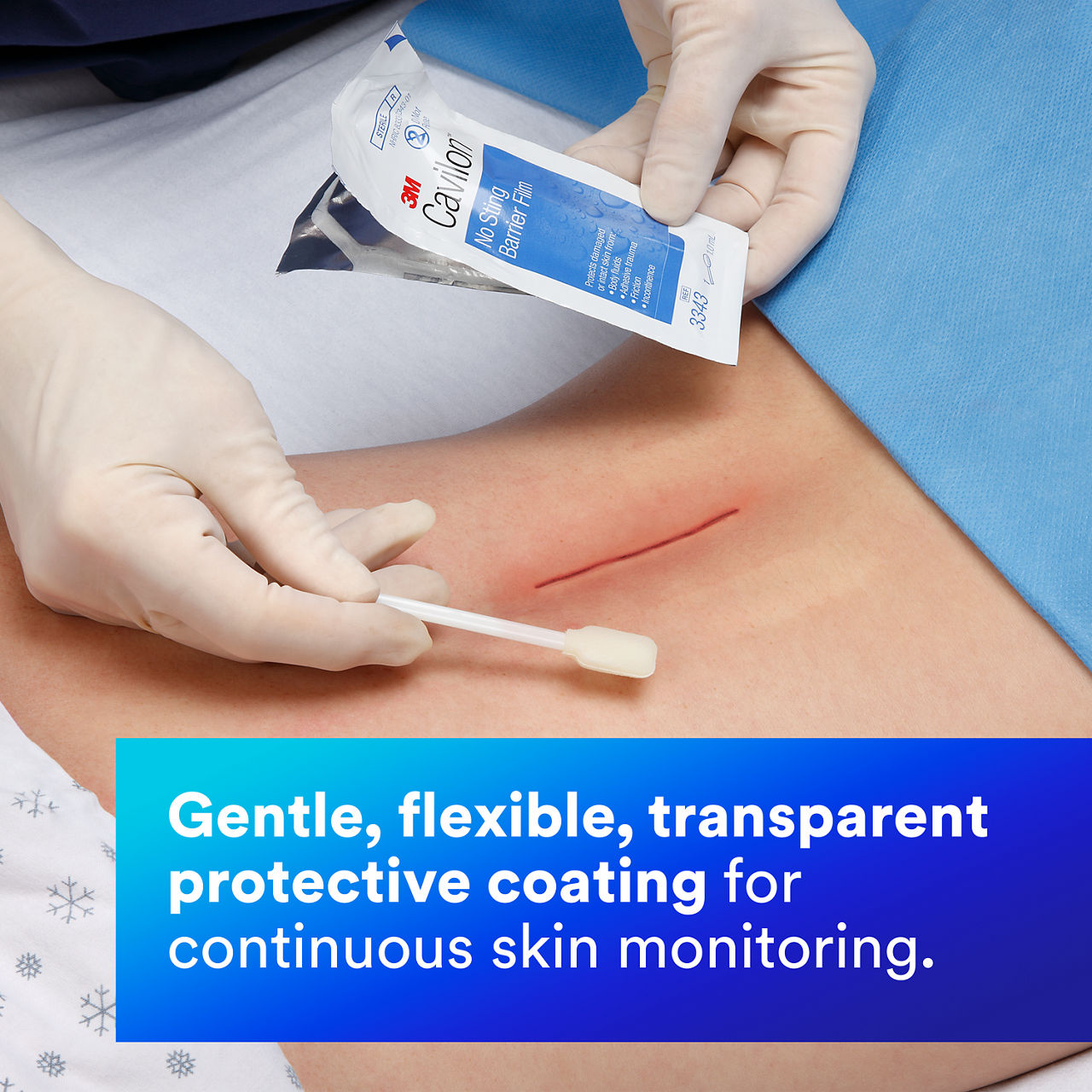 3 - Cavilon No Sting: Gentle, flexible, transparent protective coating (en-ca)