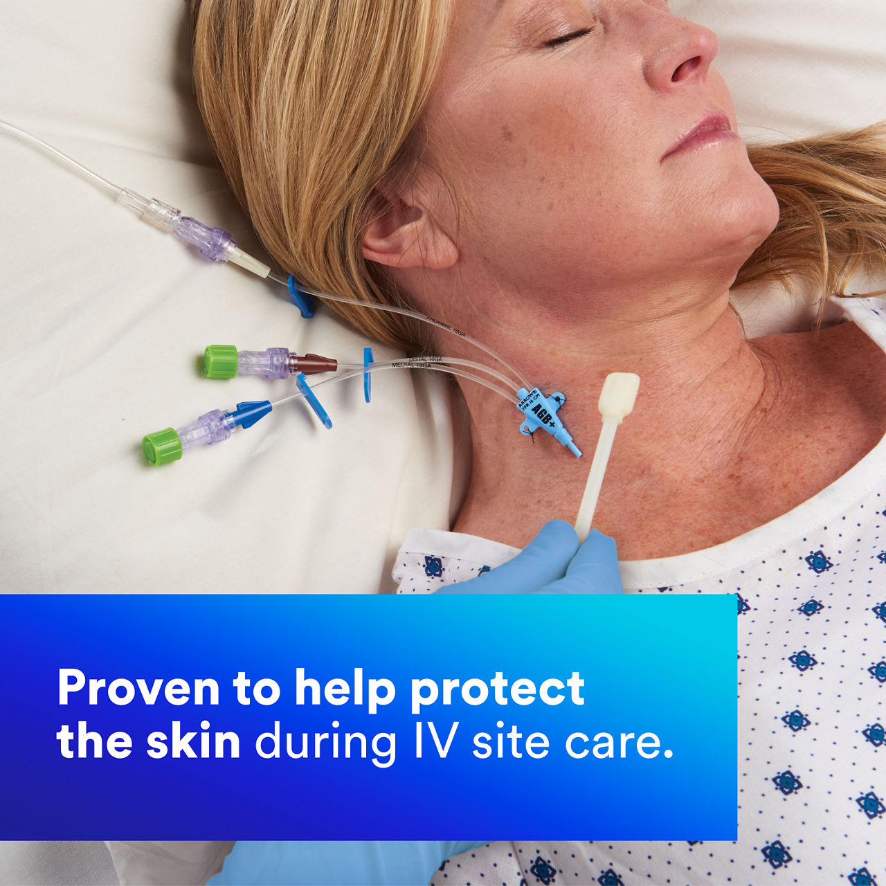 (4) Cavilon No Sting Barrier Film: Proven to help protect the skin during IV site care