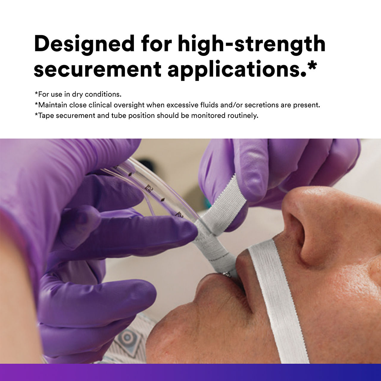 (2) Multipore Dry Surgical Tape: Designed for high strength securement applications