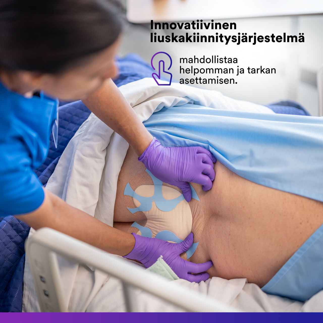 (3) Tegaderm™ Silicone Foam - ristiluu: Innovatiivinen piikkijärjestelmä