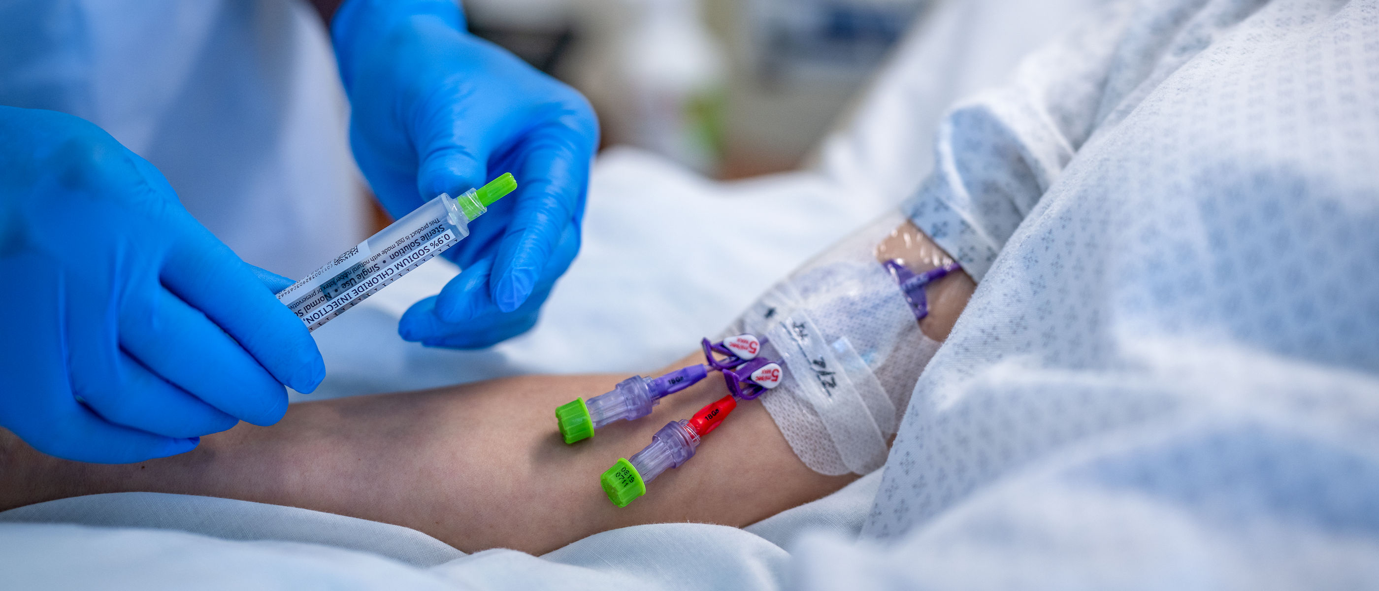Curos caps per il Clinico ospitando una linea con Curos™ Tips con un paziente con una linea PICC tappata da