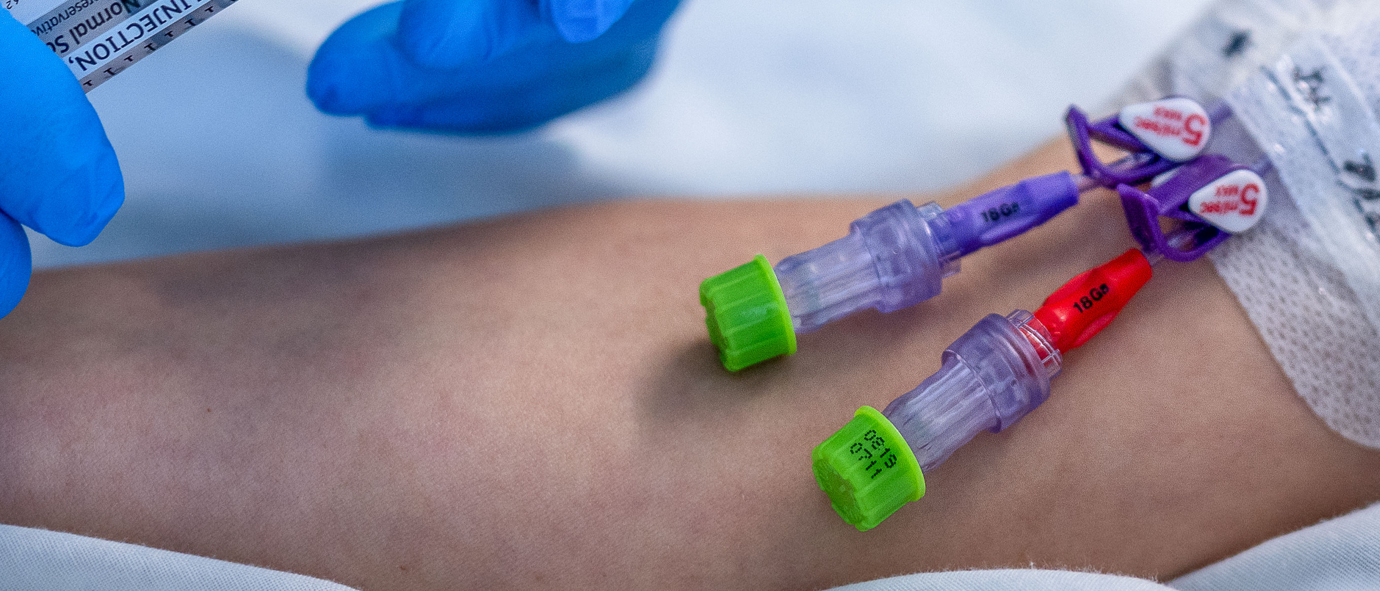 Capuchons Curos pour le clinicien hébergeant une ligne avec des Embouts Curos™ avec un patient avec une ligne PICC coiffée par