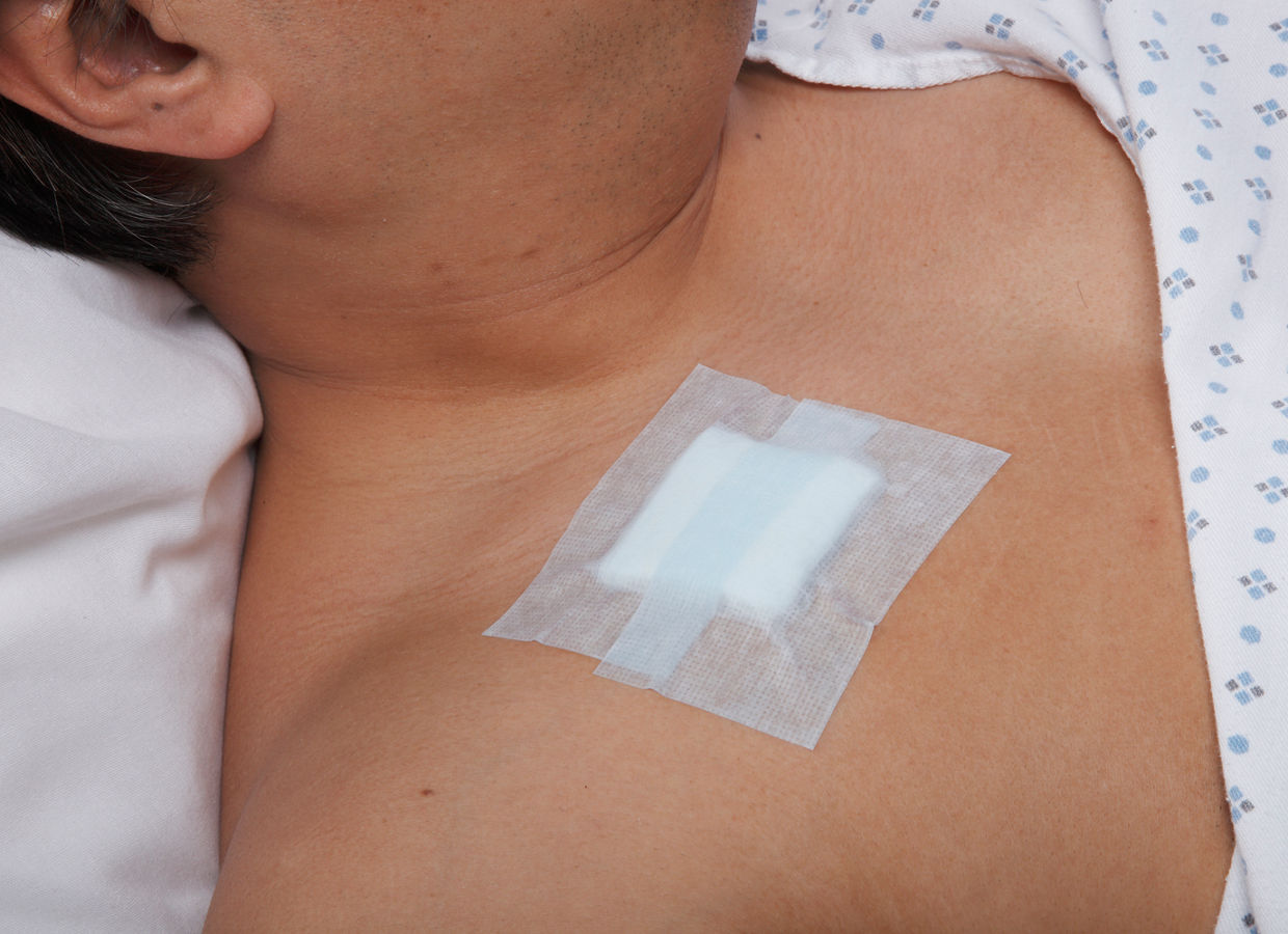 Kind Removal Silicone Tape, 2770-1, 2770-2, 2775-0, 2775-1, 2775-2, Chest application, Clavicle application, Male patient, Hypoallergenic, Surgical Tapes, Medical Tapes, Wound Care, Application image, rgb, 150dpi jpeg. Reference model release 1002532 for rights and terms of use.